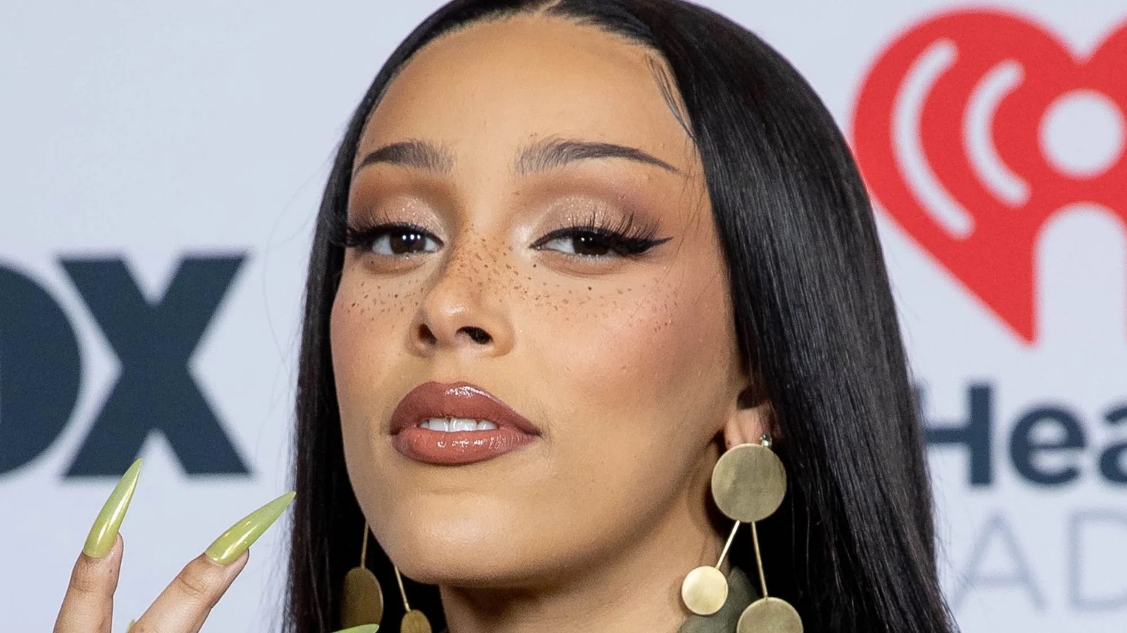 Doja Cat acusa a su hermano de haberle roto los dientes Doja Cat acusa a su hermano de haberle roto los dientes
