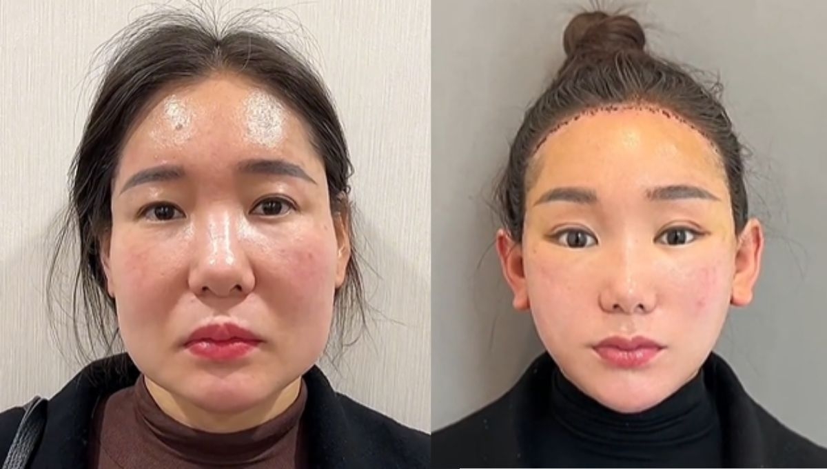 Así son las cirugías plásticas del doctor Kim Así son las cirugías plásticas del doctor Kim