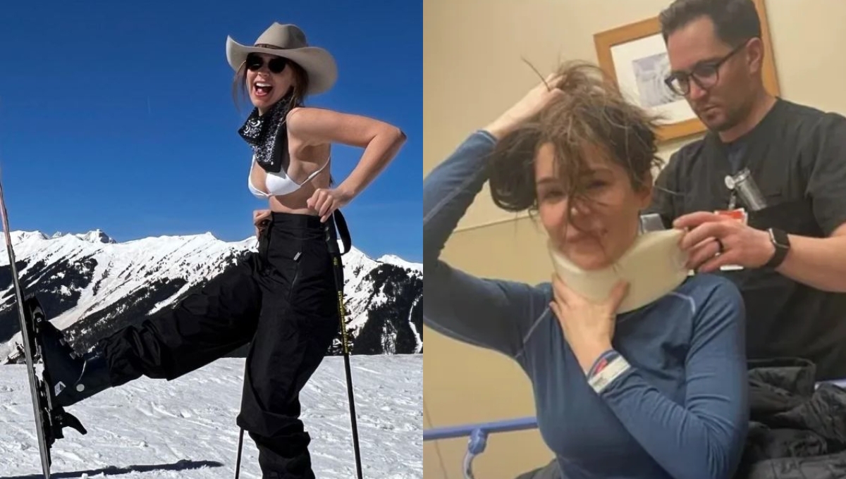 Camila Sodi ya registra una mejoría en sus heridas Camila Sodi ya registra una mejoría en sus heridas