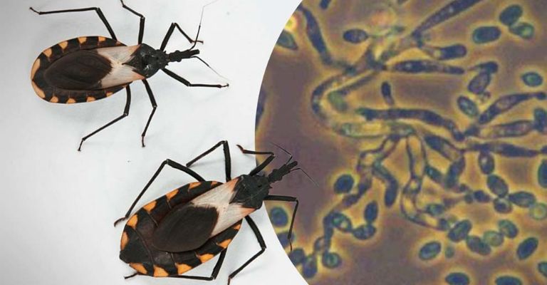 Lo que debes saber sobre el Mal de Chagas: síntomas, contagio y prevención