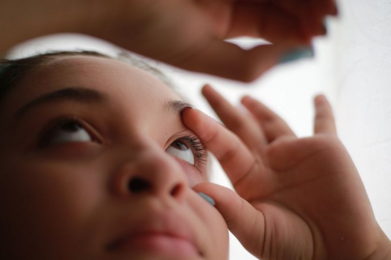 Conjuntivitis se dispara en la Península de Yucatán: más de 12 mil casos

